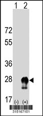 Western blot analysis of his-tag STMN2 (arrow) using his tag antibody. 293T cell lysates (2 ug/lane) either nontransfected (Lane 1) or transiently transfected with the STMN2 gene‘