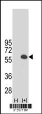 Western blot analysis of his-tag TSEN54 (arrow) using his tag antibody. 293 cell lysates (2 ug/lane) either nontransfected (Lane 2) or transiently transfected with theTSEN54 gene