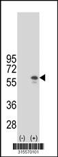 Western blot analysis of his-tag SGSH (arrow) using his tag antibody. 293 cell lysates (2 ug/lane) either nontransfected (Lane 2) or transiently transfected with theSGSH gene