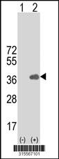 Western blot analysis of his-tag GIMAP1 (arrow) using his tag antibody. 293 cell lysates (2 ug/lane) either nontransfected (Lane 2) or transiently transfected with theGIMAP1 gene