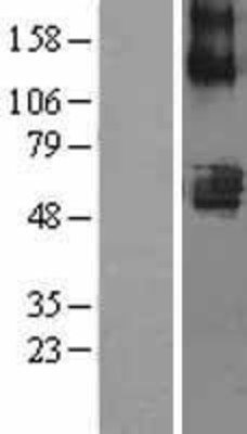 Western Blot: SLC22A7 Overexpression Lysate (Adult Normal) [NBL1-16040] Left-Empty vector transfected control cell lysate (HEK293 cell lysate); Right -Over-expression Lysate for SLC22A7.