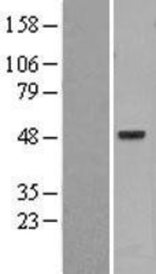 Western Blot: PSKH1 Overexpression Lysate (Adult Normal) [NBL1-14870] Left-Empty vector transfected control cell lysate (HEK293 cell lysate); Right -Over-expression Lysate for PSKH1.