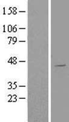 Western Blot: AGPAT5 Overexpression Lysate (Adult Normal) [NBL1-07386] Left-Empty vector transfected control cell lysate (HEK293 cell lysate); Right -Over-expression Lysate for AGPAT5.