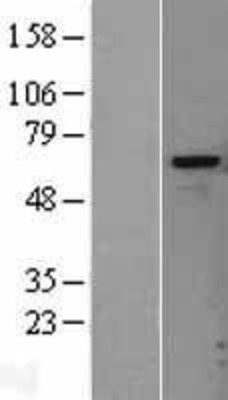Western Blot: Heparanase Overexpression Lysate (Adult Normal) [NBL1-11701] Left-Empty vector transfected control cell lysate (HEK293 cell lysate); Right -Over-expression Lysate for Heparanase.