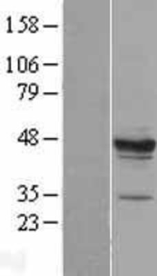 Western Blot: MPST Overexpression Lysate (Adult Normal) [NBL1-13210] Left-Empty vector transfected control cell lysate (HEK293 cell lysate); Right -Over-expression Lysate for MPST.