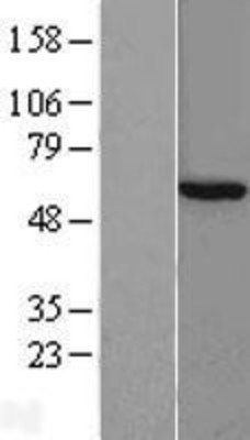 Western Blot: CCT8 Overexpression Lysate (Adult Normal) [NBL1-08903] Left-Empty vector transfected control cell lysate (HEK293 cell lysate); Right -Over-expression Lysate for CCT8.