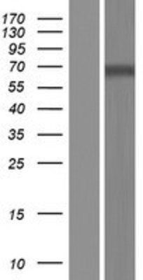 Western Blot: Dopamine beta Hydroxylase Overexpression Lysate (Adult Normal) [NBL1-09727] Left-Empty vector transfected control cell lysate (HEK293 cell lysate); Right -Over-expression Lysate for Dopamine beta Hydroxylase.