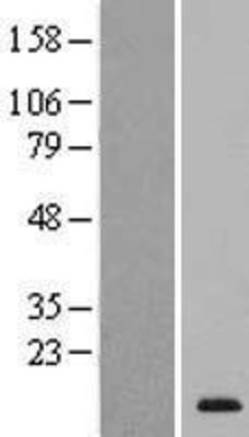 Western Blot: SPACA4 Overexpression Lysate (Adult Normal) [NBL1-16363] Left-Empty vector transfected control cell lysate (HEK293 cell lysate); Right -Over-expression Lysate for SPACA4.
