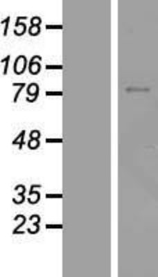 Western Blot: ZNF334 Overexpression Lysate (Adult Normal) [NBL1-18122] Left-Empty vector transfected control cell lysate (HEK293 cell lysate); Right -Over-expression Lysate for ZNF334.