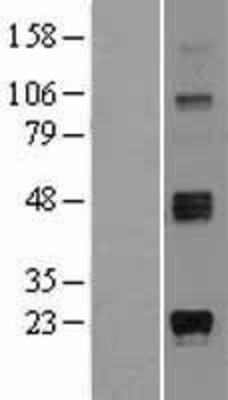 Western Blot: Ganaglioside GD3 Overexpression Lysate (Adult Normal) [NBL1-16505] Left-Empty vector transfected control cell lysate (HEK293 cell lysate); Right -Over-expression Lysate for Ganaglioside GD3.