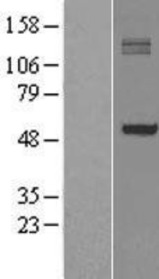 Western Blot: P4HA1 Overexpression Lysate (Adult Normal) [NBL1-14050] Left-Empty vector transfected control cell lysate (HEK293 cell lysate); Right -Over-expression Lysate for P4HA1.