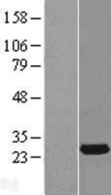 Western Blot: RAB14 Overexpression Lysate (Adult Normal) [NBL1-15041] Left-Empty vector transfected control cell lysate (HEK293 cell lysate); Right -Over-expression Lysate for RAB14.