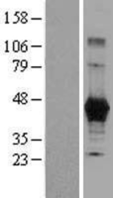 Western Blot: Carboxypeptidase M Overexpression Lysate (Adult Normal) [NBL1-09438] Left-Empty vector transfected control cell lysate (HEK293 cell lysate); Right -Over-expression Lysate for Carboxypeptidase M.