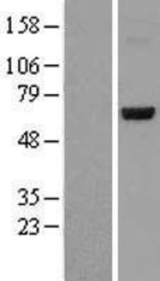 Western Blot: Ceramide Kinase Like Overexpression Lysate (Adult Normal) [NBL1-09111] Left-Empty vector transfected control cell lysate (HEK293 cell lysate); Right -Over-expression Lysate for Ceramide Kinase Like.
