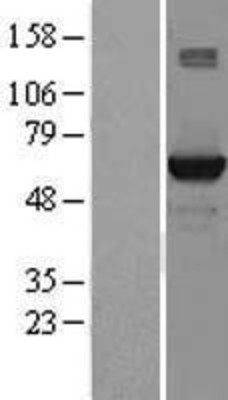 Western Blot: STK39 Overexpression Lysate (Adult Normal) [NBL1-16554] Left-Empty vector transfected control cell lysate (HEK293 cell lysate); Right -Over-expression Lysate for STK39.
