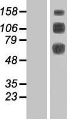 Western Blot: CLEC14A Overexpression Lysate (Adult Normal) [NBL1-09255] Left-Empty vector transfected control cell lysate (HEK293 cell lysate); Right -Over-expression Lysate for CLEC14A.