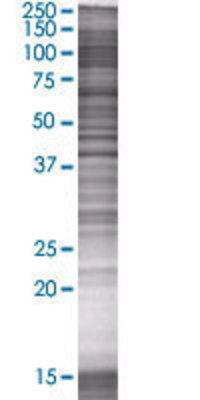 CCNDBP1 transfected lysate.
