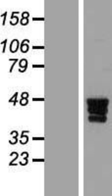 Western Blot: ZNF362 Overexpression Lysate (Adult Normal) [NBL1-18133] Left-Empty vector transfected control cell lysate (HEK293 cell lysate); Right -Over-expression Lysate for ZNF362.