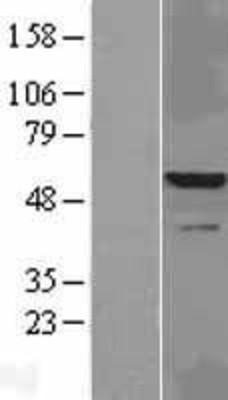 Western Blot: IRAK4 Overexpression Lysate (Adult Normal) [NBL1-12028] Left-Empty vector transfected control cell lysate (HEK293 cell lysate); Right -Over-expression Lysate for IRAK4.