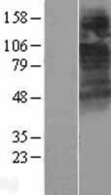 Western Blot: CTNS Overexpression Lysate (Adult Normal) [NBL1-09579] Left-Empty vector transfected control cell lysate (HEK293 cell lysate); Right -Over-expression Lysate for CTNS.