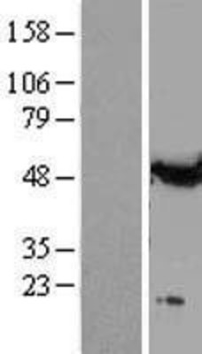 Western Blot: alpha Tubulin Overexpression Lysate (Adult Normal) [NBL1-17427] Left-Empty vector transfected control cell lysate (HEK293 cell lysate); Right -Over-expression Lysate for alpha Tubulin.