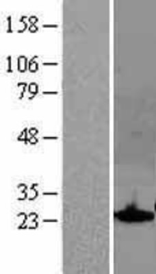 Western Blot: SOCS1 Overexpression Lysate (Adult Normal) [NBL1-16325] Left-Empty vector transfected control cell lysate (HEK293 cell lysate); Right -Over-expression Lysate for SOCS1.