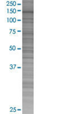 DHX16 transfected lysate.