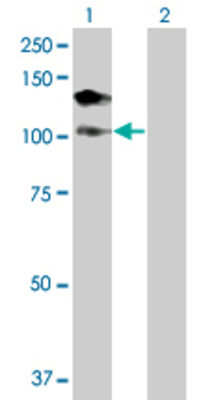 Lane 1: DHX16 transfected lysate (114.73 KDa) Lane 2: Non-transfected lysate.