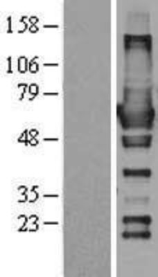 Western Blot: RIC8 Overexpression Lysate (Adult Normal) [NBL1-15368] Left-Empty vector transfected control cell lysate (HEK293 cell lysate); Right -Over-expression Lysate for RIC8.
