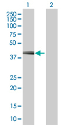 Lane 1: CFHL1 transfected lysate (37.7 KDa) Lane 2: Non-transfected lysate.
