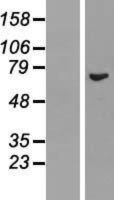 Western Blot: REC8 Overexpression Lysate (Adult Normal) [NBL1-15263] Left-Empty vector transfected control cell lysate (HEK293 cell lysate); Right -Over-expression Lysate for REC8.