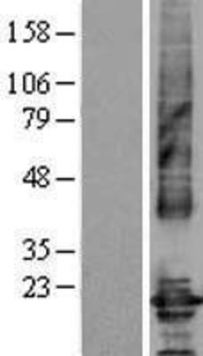Western Blot: Claudin 4 Overexpression Lysate (Adult Normal) [NBL1-09246] Left-Empty vector transfected control cell lysate (HEK293 cell lysate); Right -Over-expression Lysate for Claudin 4.