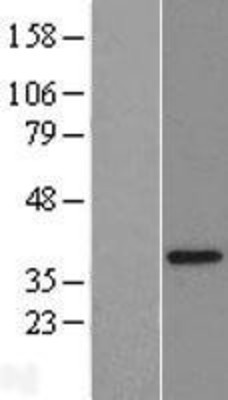 Western Blot: CGI 62 Overexpression Lysate (Adult Normal) [NBL1-10491] Left-Empty vector transfected control cell lysate (HEK293 cell lysate); Right -Over-expression Lysate for CGI 62.