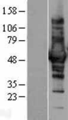 Western Blot: CORO1B Overexpression Lysate (Adult Normal) [NBL1-09396] Left-Empty vector transfected control cell lysate (HEK293 cell lysate); Right -Over-expression Lysate for CORO1B.