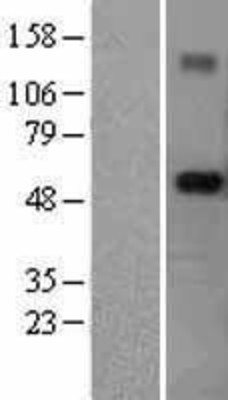Western Blot: RNF89 Overexpression Lysate (Adult Normal) [NBL1-17309] Left-Empty vector transfected control cell lysate (HEK293 cell lysate); Right -Over-expression Lysate for RNF89.