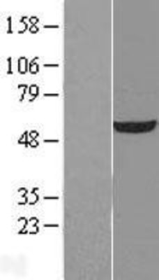 Western Blot: UDP glucose dehydrogenase Overexpression Lysate (Adult Normal) [NBL1-17594] Left-Empty vector transfected control cell lysate (HEK293 cell lysate); Right -Over-expression Lysate for UDP glucose dehydrogenase.