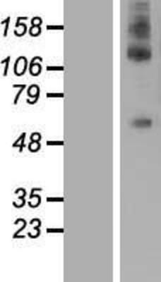 Western Blot: DEPDC1A Overexpression Lysate (Adult Normal) [NBL1-09833] Left-Empty vector transfected control cell lysate (HEK293 cell lysate); Right -Over-expression Lysate for DEPDC1A.