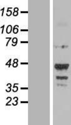 Western Blot: NOTUM Overexpression Lysate (Adult Normal) [NBL1-13728] Left-Empty vector transfected control cell lysate (HEK293 cell lysate); Right -Over-expression Lysate for NOTUM.