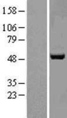 Western Blot: APMAP Overexpression Lysate (Adult Normal) [NBL1-08371] Left-Empty vector transfected control cell lysate (HEK293 cell lysate); Right -Over-expression Lysate for APMAP.