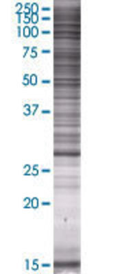 VAPB transfected lysate.