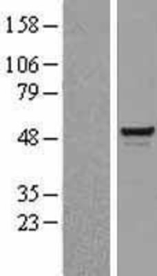 Western Blot: BAF57 Overexpression Lysate (Adult Normal) [NBL1-16235] Left-Empty vector transfected control cell lysate (HEK293 cell lysate); Right -Over-expression Lysate for BAF57.