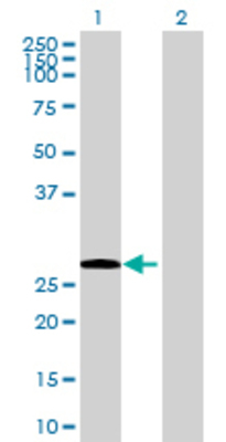 Lane 1: VAPB transfected lysate (26.84 KDa) Lane 2: Non-transfected lysate.