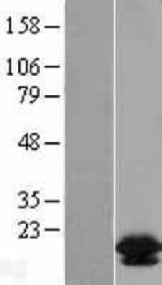 Western Blot: Bcl2L2 Overexpression Lysate (Adult Normal) [NBL1-07950] Left-Empty vector transfected control cell lysate (HEK293 cell lysate); Right -Over-expression Lysate for Bcl2L2.
