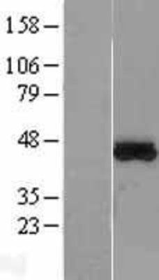 Western Blot: MTRF1L Overexpression Lysate (Adult Normal) [NBL1-13384] Left-Empty vector transfected control cell lysate (HEK293 cell lysate); Right -Over-expression Lysate for MTRF1L.