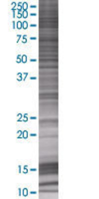 PEMT transfected lysate.