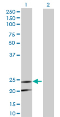 Lane 1: PEMT transfected lysate (26.07 KDa) Lane 2: Non-transfected lysate.