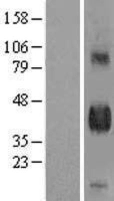 Western Blot: DLK1 Overexpression Lysate (Adult Normal) [NBL1-09913] Left-Empty vector transfected control cell lysate (HEK293 cell lysate); Right -Over-expression Lysate for DLK1.