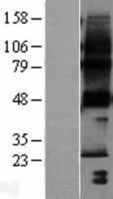 Western Blot: PTPLA Overexpression Lysate (Adult Normal) [NBL1-14964] Left-Empty vector transfected control cell lysate (HEK293 cell lysate); Right -Over-expression Lysate for PTPLA.