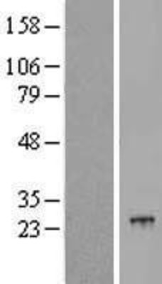 Western Blot: POLR2G Overexpression Lysate (Adult Normal) [NBL1-14584] Left-Empty vector transfected control cell lysate (HEK293 cell lysate); Right -Over-expression Lysate for POLR2G.