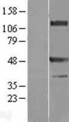 Western Blot: TRAF1 Overexpression Lysate (Adult Normal) [NBL1-17239] Left-Empty vector transfected control cell lysate (HEK293 cell lysate); Right -Over-expression Lysate for TRAF1.